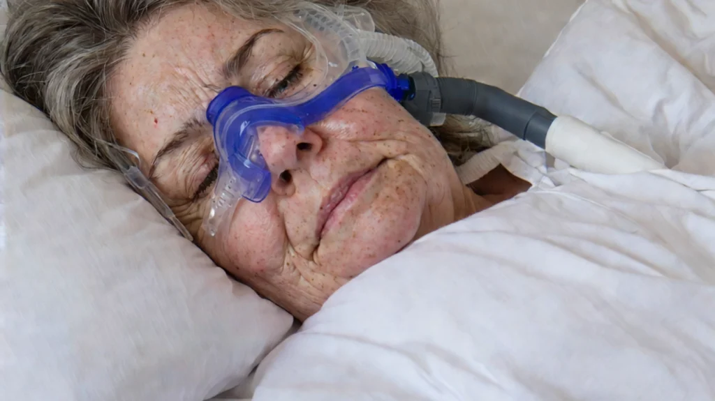 An elderly woman wearing a CPAP (Continuous Positive Airway Pressure) mask connected to a tube while lying in bed, symbolizing treatment for Obstructive Sleep Apnea (OSA). The CPAP device helps maintain airway patency and ensure uninterrupted breathing during sleep.